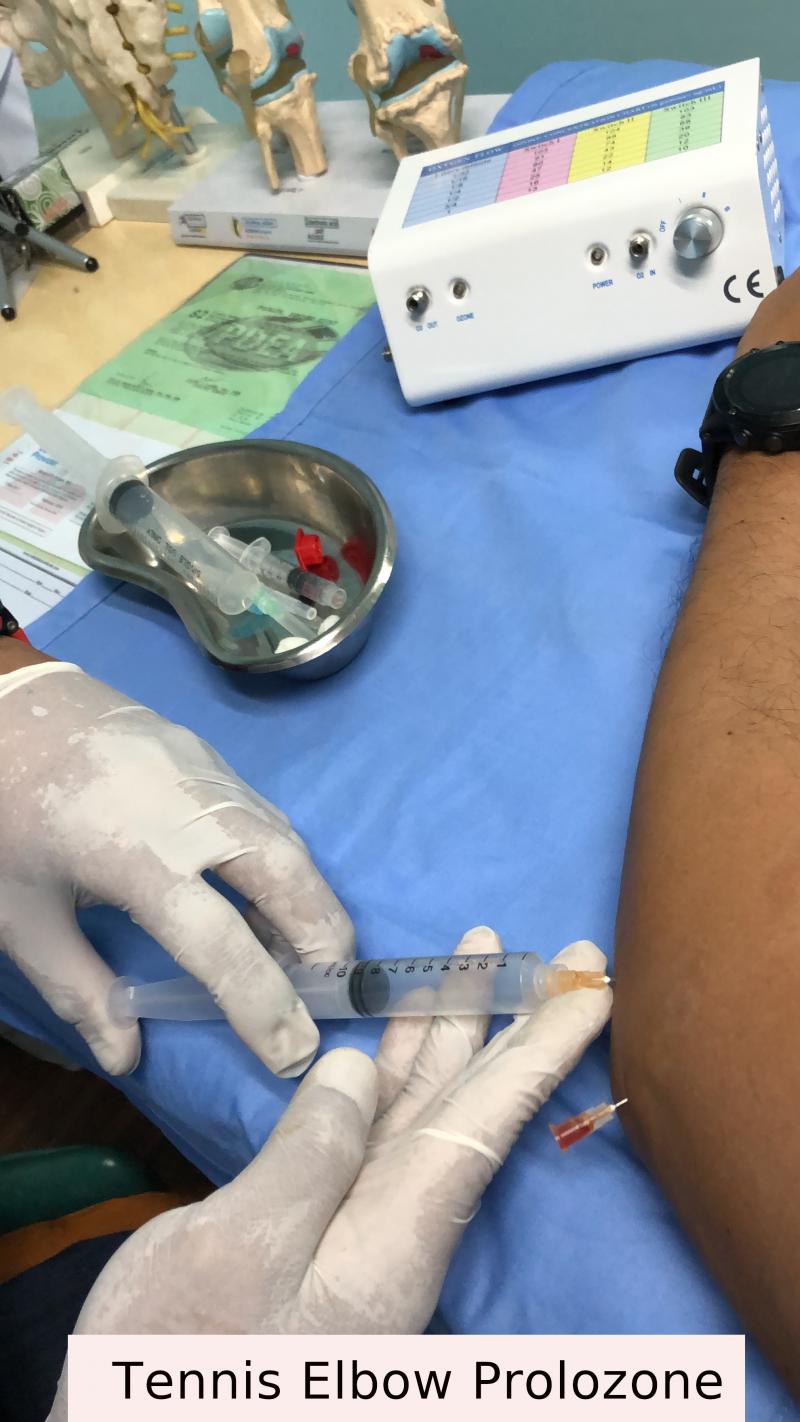Prolozone Injection Therapy at Brenton Turner blog